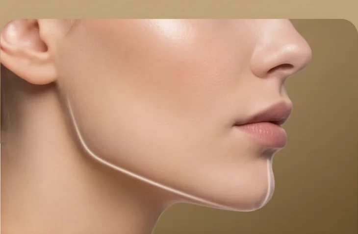 Çene (Jawline) Dolgusu